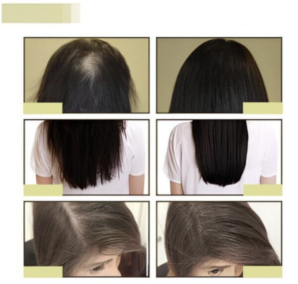 EELHOE Hair Growth Oil – Τι είναι και πώς λειτουργεί