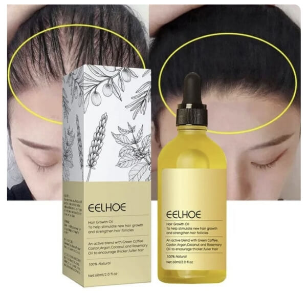 Τιμή του EELHOE Hair Growth Oil στην Ελλάδα – Πού να το αγοράσετε